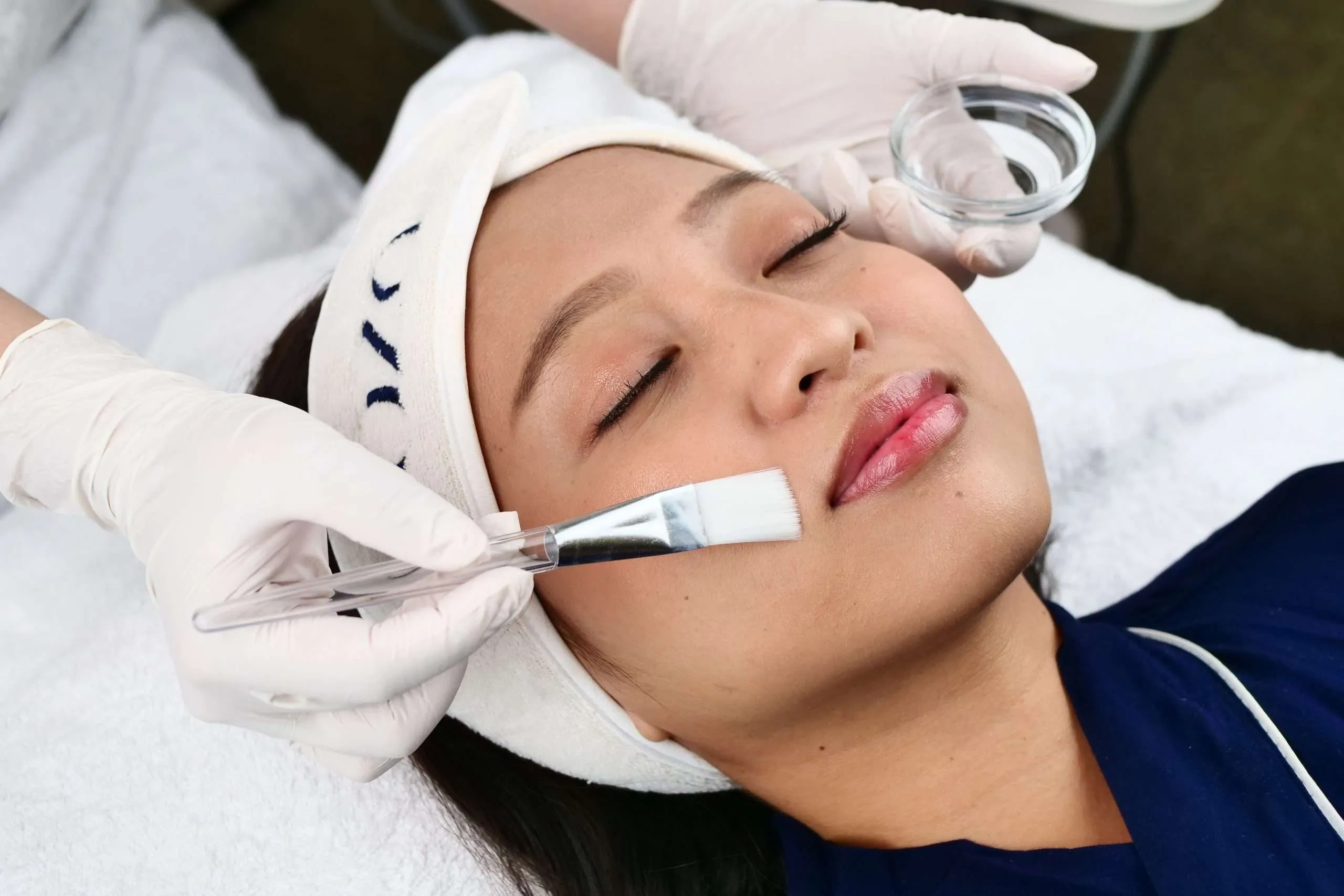 Acne Dermapeel