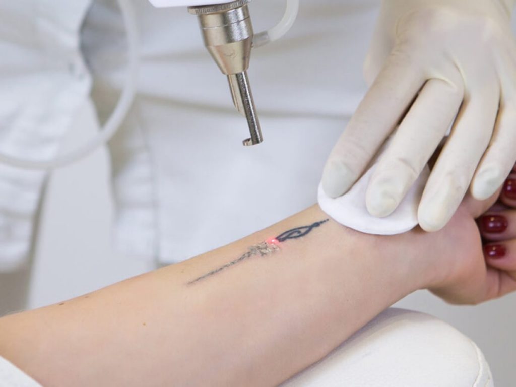 PICO TATTO LEVEL 1